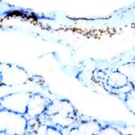 CD134 Antibody in Immunohistochemistry (Paraffin) (IHC (P))