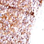 CD22 Antibody in Immunohistochemistry (Paraffin) (IHC (P))