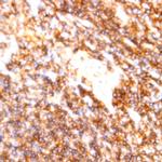 CD22 Antibody in Immunohistochemistry (Paraffin) (IHC (P))