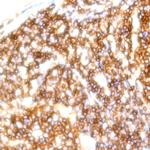 CD30 Antibody in Immunohistochemistry (Paraffin) (IHC (P))