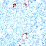 CD38 Antibody in Immunohistochemistry (Paraffin) (IHC (P))