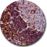 CD44 Antibody in Immunohistochemistry (Paraffin) (IHC (P))