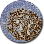 Ki-67 Antibody in Immunohistochemistry (Paraffin) (IHC (P))