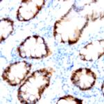 TIA-1 Antibody in Immunohistochemistry (Paraffin) (IHC (P))