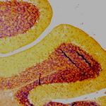 Synaptophysin Antibody in Immunohistochemistry (Paraffin) (IHC (P))