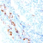 CD36 Antibody in Immunohistochemistry (Paraffin) (IHC (P))