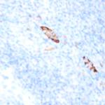 CD38 Antibody in Immunohistochemistry (Paraffin) (IHC (P))