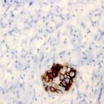 CD58 Antibody in Immunohistochemistry (Paraffin) (IHC (P))