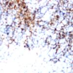 CD71 Antibody in Immunohistochemistry (Paraffin) (IHC (P))