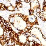 EpCam Antibody in Immunohistochemistry (Paraffin) (IHC (P))