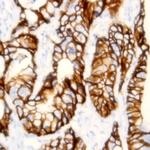 EpCam Antibody in Immunohistochemistry (Paraffin) (IHC (P))