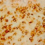 AXL Antibody in Immunohistochemistry (Paraffin) (IHC (P))
