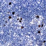CD71 Antibody in Immunohistochemistry (Paraffin) (IHC (P))