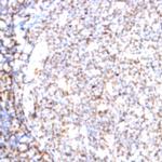 CD71 Antibody in Immunohistochemistry (Paraffin) (IHC (P))