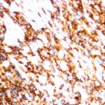 CD79b Antibody in Immunohistochemistry (Paraffin) (IHC (P))