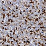 CD61 Antibody in Immunohistochemistry (Paraffin) (IHC (P))