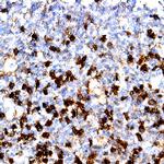 CD34 Antibody in Immunohistochemistry (Paraffin) (IHC (P))
