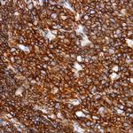 CD3 Antibody in Immunohistochemistry (Paraffin) (IHC (P))