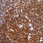 CD3 Antibody in Immunohistochemistry (Paraffin) (IHC (P))