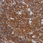CD3e Antibody in Immunohistochemistry (Paraffin) (IHC (P))
