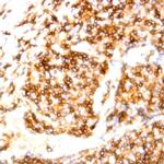 CD15/SSEA-1 Antibody in Immunohistochemistry (Paraffin) (IHC (P))