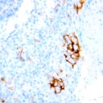 CD74 Antibody in Immunohistochemistry (Paraffin) (IHC (P))