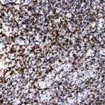 Lambda Light Chain Antibody in Immunohistochemistry (Paraffin) (IHC (P))