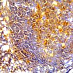 PD-L1 Antibody in Immunohistochemistry (Paraffin) (IHC (P))