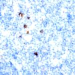 CD29 Antibody in Immunohistochemistry (Paraffin) (IHC (P))