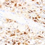 B7H4 (VTCN1) Antibody in Immunohistochemistry (Paraffin) (IHC (P))