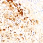 PD-L1 (CD274) Antibody in Immunohistochemistry (Paraffin) (IHC (P))