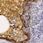 Thyroglobulin Antibody in Immunohistochemistry (Paraffin) (IHC (P))
