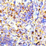 ZAP-70 Antibody in Immunohistochemistry (Paraffin) (IHC (P))