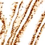 Cyclin D1 Antibody in Immunohistochemistry (Paraffin) (IHC (P))