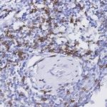 Perforin Antibody in Immunohistochemistry (Paraffin) (IHC (P))