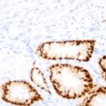 NBD1 Antibody in Immunohistochemistry (Paraffin) (IHC (P))