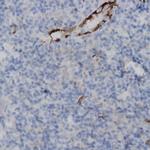 TTF1 (thyroid transcription factor 1) Antibody in Immunohistochemistry (Paraffin) (IHC (P))