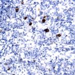TdT Antibody in Immunohistochemistry (Paraffin) (IHC (P))