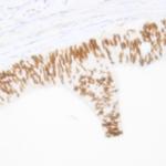 MDM2 Antibody in Immunohistochemistry (Paraffin) (IHC (P))