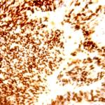 Retinoblastoma (RB) Antibody in Immunohistochemistry (Paraffin) (IHC (P))