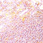 IL-2 Antibody in Immunohistochemistry (Paraffin) (IHC (P))
