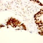 Progesterone Receptor (PR) Antibody in Immunohistochemistry (Paraffin) (IHC (P))