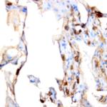 GUCY1B3 (GCS-b-1) Antibody in Immunohistochemistry (Paraffin) (IHC (P))
