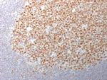 Bcl-6 Antibody in Immunohistochemistry (Paraffin) (IHC (P))