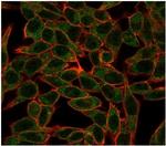BCL6 Antibody in Immunocytochemistry (ICC/IF)