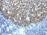 Bcl-6 (Follicular Lymphoma Marker) Antibody in Immunohistochemistry (Paraffin) (IHC (P))