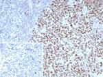 Bcl-6 (Follicular Lymphoma Marker) Recombinant Rabbit Monoclonal Antibody (BCL6/8983R)