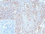 Bcl-6 (Follicular Lymphoma Marker) Recombinant Rabbit Monoclonal Antibody (BCL6/9222R)
