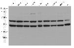 ATAD1 Antibody in Western Blot (WB)