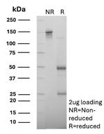 BACH2 (Transcription Factor) Antibody in SDS-PAGE (SDS-PAGE)